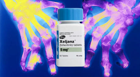 Is Xeljanz Right for You ? Key Factors to Consider Before Starting Treatment