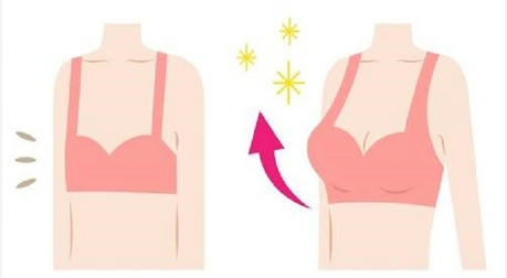 Everything You Need to Know Before Getting Breast Augmentation Surgery